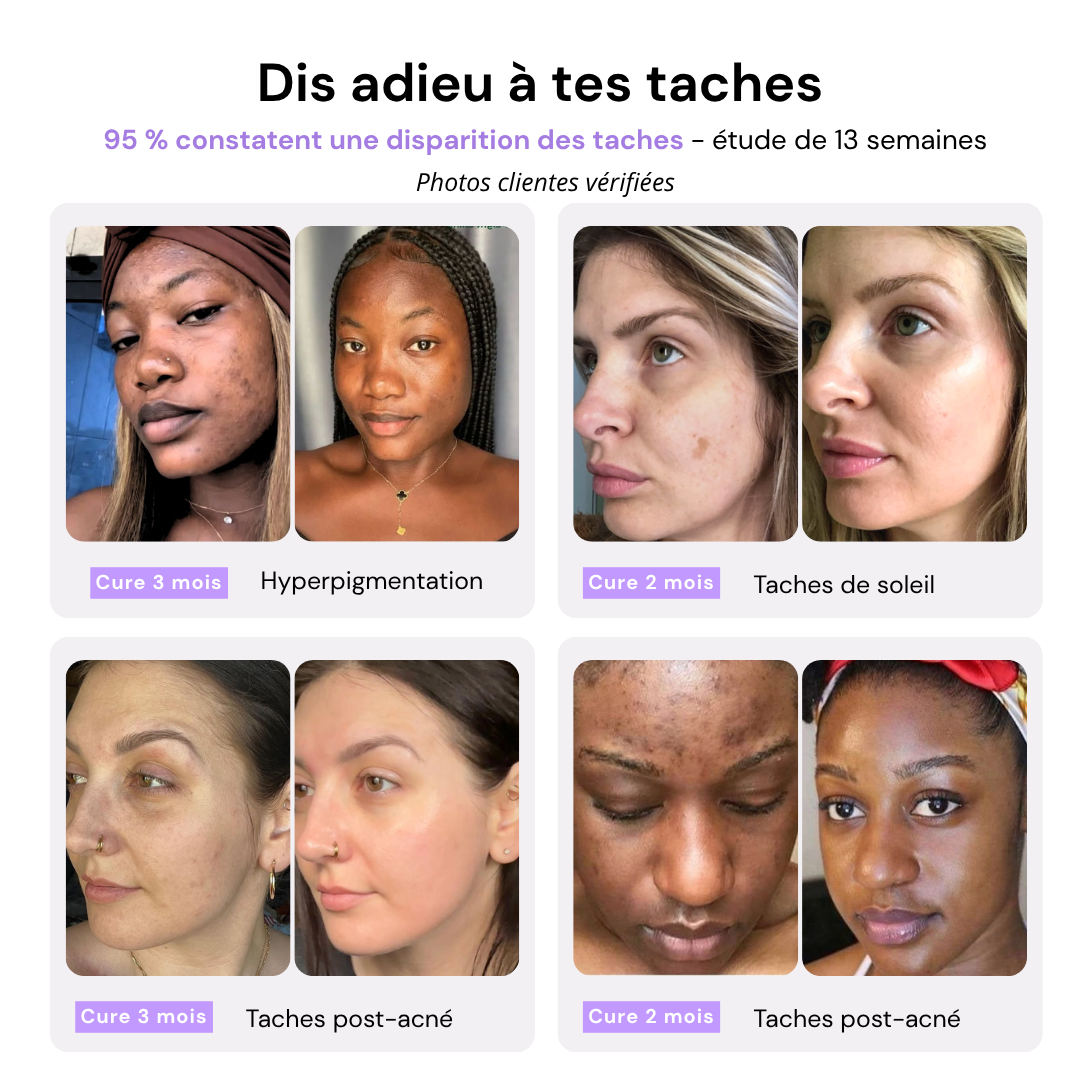 Aloe Vera Patches - Intense Hydration