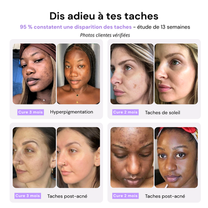 Sérum Regliss Anti-taches™