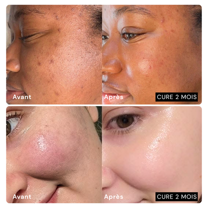 Aloe Vera Patches - Intense Hydration