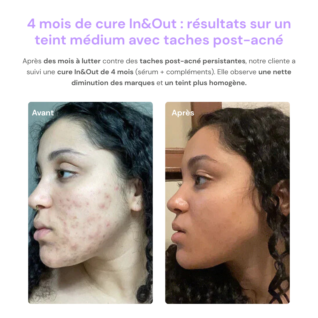 Sérum Regliss Anti-taches™