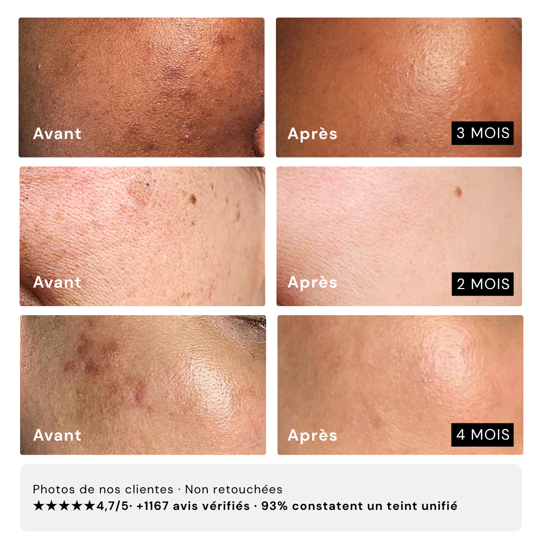 Sérum Regliss Anti-taches™