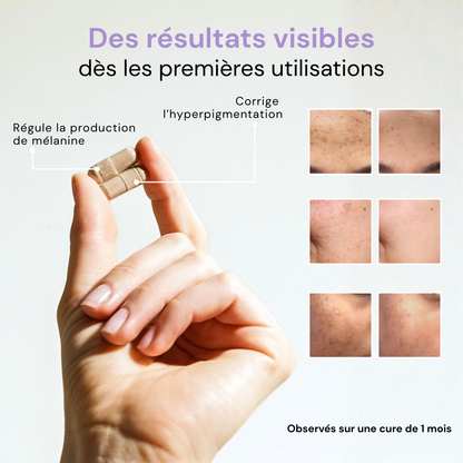 Aloe Vera Patches - Intense Hydration