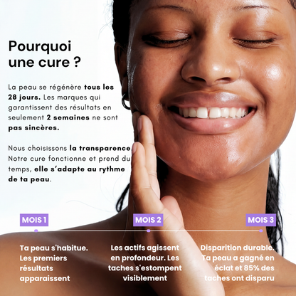 Aloe Vera Patches - Intense Hydration